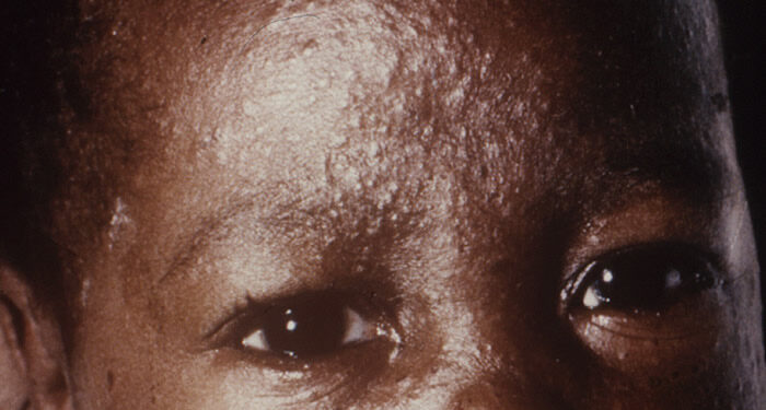 Ntεnkyεm ne nsεnkyerεnne a sε obi nya bi a εda adi