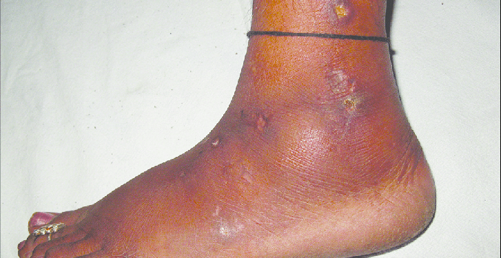 Ekuro/Ekunini a ԑtᴐ onipa nan ase