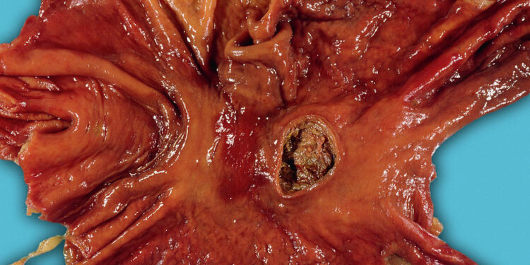 Ekuro, Kisikuro, anaa Ekunini ho asԑm kakra