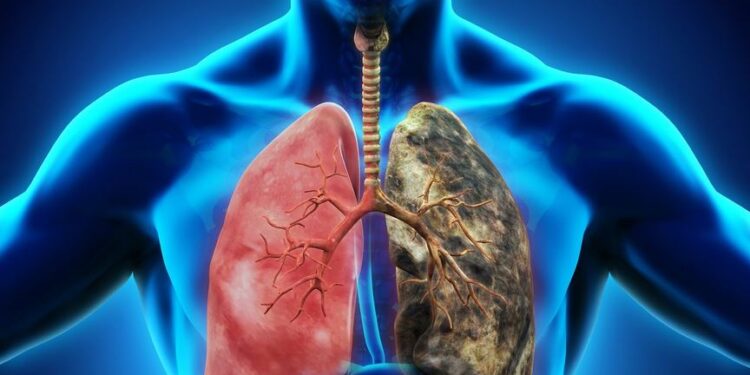 Ↄkwan a mfuturo fa so di nipadua no nya