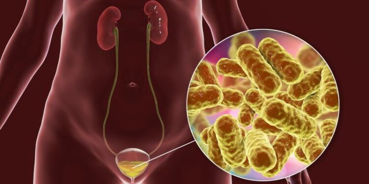 Dwonsɔ akwaa mu haw, ɛho nsɛnkyerɛnneɛ ne deɛ ɛtumi bɔ kwan ma no ba